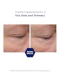 Intensive Eye Therapy 15g